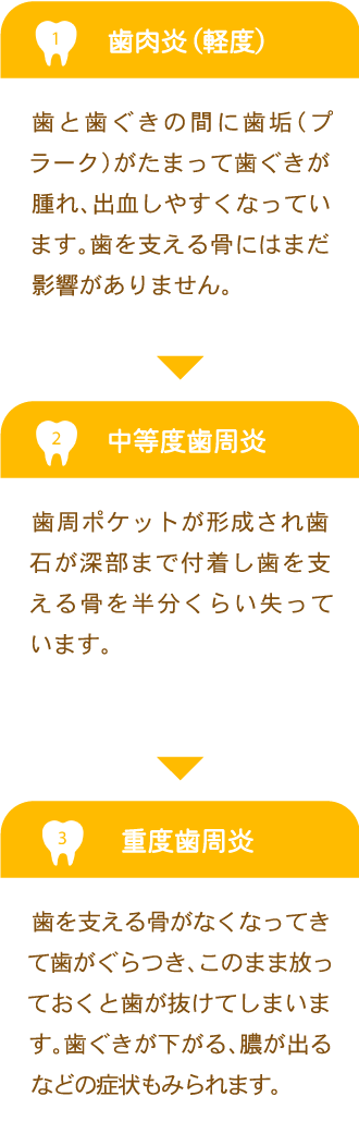 歯周病について