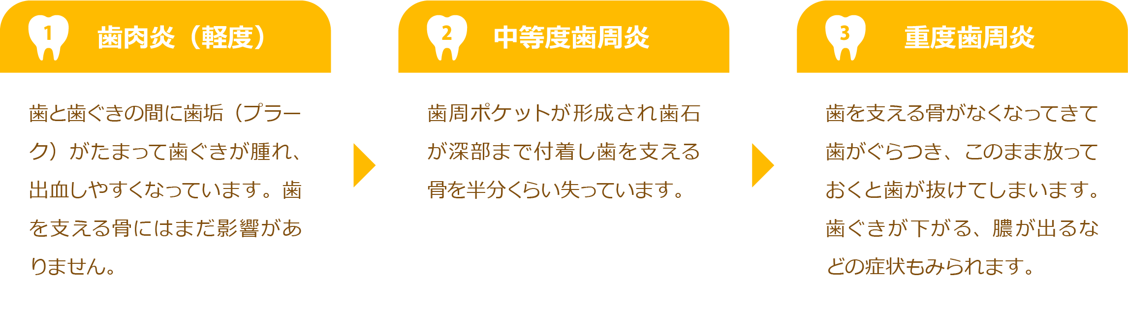 歯周病について