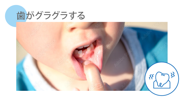 ぐらぐらする