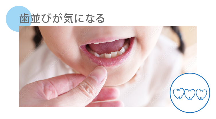 歯並びが気になる