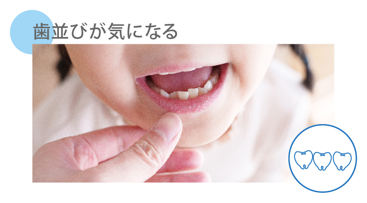 歯並びが気になる